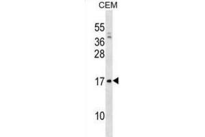 Western Blotting (WB) image for anti-Pre-B Lymphocyte 1 (VPREB1) antibody (ABIN3000848)