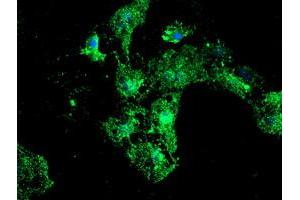 Anti-PSMB9 mouse monoclonal antibody (ABIN2455595) immunofluorescent staining of COS7 cells transiently transfected by pCMV6-ENTRY PSMB9 (RC209001). (PSMB9 antibody  (AA 21-219))