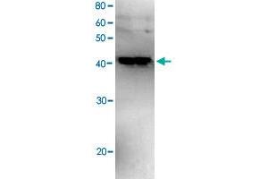 Western blot analysis of recombinant Polb with Polb polyclonal antibody . (POLB antibody)