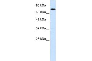 WB Suggested Anti-ZNF167 Antibody Titration:  1.