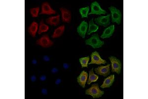 ABIN6260430 and ABIN6279214 staining Hela cells by IF/ICC. (CAMK2D antibody  (C-Term))