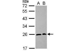 WB Image Sample (30 ug of whole cell lysate) A: 293T B: A431 12% SDS PAGE antibody diluted at 1:1000 (SAR1A antibody  (Center))