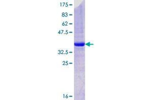 STEAP2 Protein (AA 2-100) (GST tag)