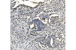 IHC analysis of NDUFB2 using anti-NDUFB2 antibody (ABIN7600162).