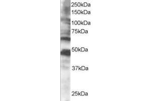 Western Blotting (WB) image for anti-Cytoplasmic Polyadenylation Element Binding Protein 1 (CPEB1) (C-Term) antibody (ABIN2465552)