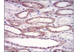 Immunohistochemistry (IHC) image for anti-Hypoxanthine phosphoribosyltransferase 1 (HPRT1) (AA 1-218) antibody (ABIN2682995)