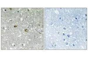 Immunohistochemistry analysis of paraffin-embedded human brain tissue using PIGH antibody. (PIGH antibody  (C-Term))