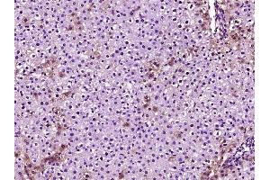 Paraformaldehyde-fixed, paraffin embedded rat liver, Antigen retrieval by boiling in sodium citrate buffer (pH6) for 15min, Block endogenous peroxidase by 3% hydrogen peroxide for 30 minutes, Blocking buffer (normal goat serum) at 37°C for 20min, Antibody incubation with Apolipoprotein E Polyclonal Antibody, Unconjugated  at 1:400 overnight at 4°C, followed by a conjugated secondary and DAB staining. (APOE antibody  (AA 151-250))