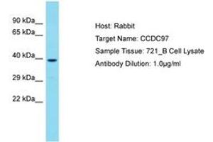 Image no. 1 for anti-Coiled-Coil Domain Containing 97 (CCDC97) (C-Term) antibody (ABIN6750718) (CCDC97 antibody  (C-Term))