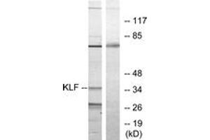 Western blot analysis of extracts from Jurkat cells, treated with serum 20% 15', using KLF Antibody. (KLF antibody  (AA 291-340))