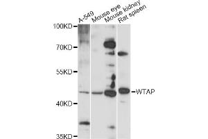 Western blot analysis of extracts of various cell lines, using WTAP antibody (ABIN6291068) at 1:1000 dilution.