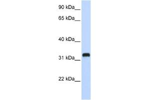 WB Suggested Anti-C21orf62 Antibody Titration:  0.
