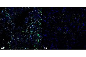 Immunofluorescence against SUR1 WT (left) and null mutant (right) mouse striatum and stained with N289/16 (green) and commercial antibody against Tyrosine Hydroxylase (blue).