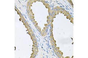 Immunohistochemistry of paraffin-embedded human prostate using ABL1 antibody.