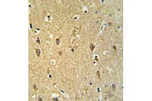 Immunohistochemistry analysis in brain tissue (formalin-fixed, paraffin-embedded) using GPR17 Antibody , followed by peroxidase conjugation of the secondary antibody and DAB staining. (GPR17 antibody  (Middle Region))