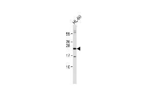 Anti-hCDKN3- at 1:2000 dilution + HL-60 whole cell lysate Lysates/proteins at 20 μg per lane. (CDKN3 antibody  (C-Term))