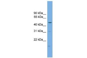 Western Blotting (WB) image for anti-Arrestin, beta 1 (ARRB1) (Middle Region) antibody (ABIN2779340)