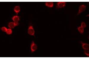ABIN6276630 staining HeLa by IF/ICC. (IL7R antibody  (N-Term))