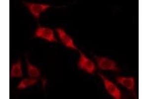 ABIN6275168 staining HT29 by IF/ICC. (GIMAP2 antibody  (Internal Region))