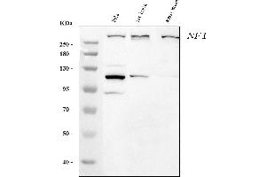 Western blot analysis of Neurofibromin/NF1 using anti-Neurofibromin/NF1 antibody (ABIN7600197).
