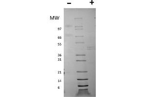 SDS-PAGE (SDS) image for Interleukin 12 (IL12) protein (ABIN6700020)