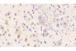 Detection of LDLRAP1 in Mouse Cerebrum Tissue using Polyclonal Antibody to Low Density Lipoprotein Receptor Adaptor Protein 1 (LDLRAP1) (LDLRAP1 antibody  (AA 1-308))