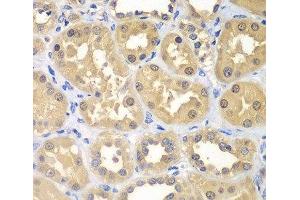 Immunohistochemistry of paraffin-embedded Human kidney using KHK Polyclonal Antibody at dilution of 1:100 (40x lens). (Ketohexokinase antibody)