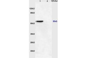 Lane 1: mouse brain lysates Lane 2: mouse heart lysates probed with Anti NFKBIE/IKB epsilon Polyclonal Antibody, Unconjugated (ABIN1386753) at 1:200 in 4 °C. (NFKBIE antibody  (AA 165-270))