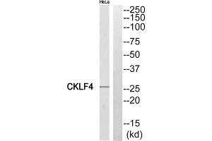 Western blot analysis of extracts from HeLa cells, using CKLF4 antibody.