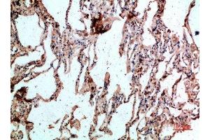 Immunohistochemical analysis of paraffin-embedded human-lung, antibody was diluted at 1:200 (CD236/GYPC antibody  (AA 11-60))