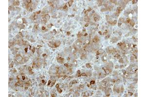 IHC-P Image Immunohistochemical analysis of paraffin-embedded MCF7 xenograft, using TBCK, antibody at 1:100 dilution. (TBCK antibody)