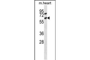 Western blot analysis in mouse heart tissue lysates (35ug/lane). (ACVR1C/ALK7 antibody  (C-Term))