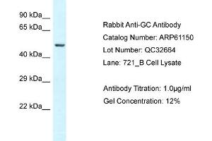 Western Blotting (WB) image for anti-Gc (N-Term) antibody (ABIN2788696) (Gc (N-Term) antibody)