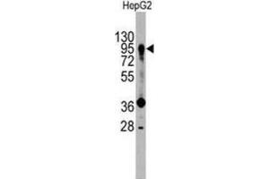 Western Blotting (WB) image for anti-Prospero Homeobox 1 (PROX1) antibody (ABIN3001422)