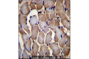 Immunohistochemistry analysis in Formalin Fixed, Paraffin Embedded Human skeletal muscle tissue stained with SEPN1 antibody (C-term) followed by peroxidase conjugation of the secondary antibody and DAB staining.