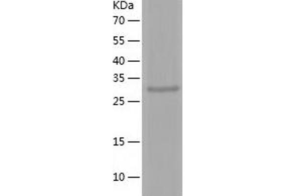 PHF13 Protein (AA 1-300) (His tag)