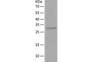 Western Blotting (WB) image for PHD Finger Protein 13 (PHF13) (AA 1-300) protein (His tag) (ABIN7124385) (PHF13 Protein (AA 1-300) (His tag))