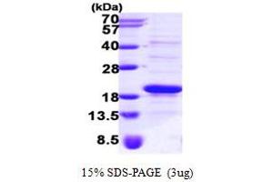 SDS-PAGE (SDS) image for Signal Recognition Particle 14kDa (Homologous Alu RNA Binding Protein) (SRP14) (AA 1-136) protein (His tag) (ABIN667276)