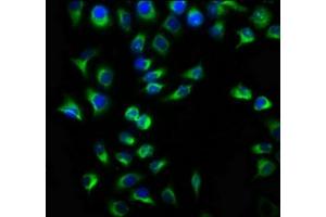 Immunofluorescence staining of A549 cells with ABIN7173043 at 1:133, counter-stained with DAPI. (TMEM127 antibody  (AA 1-95))
