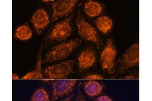 Immunofluorescence analysis of HeLa cells using MTMR9 Polyclonal Antibody at dilution of 1:100. (MTMR9 antibody)