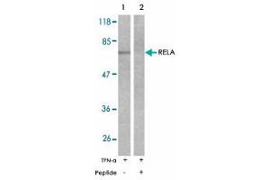 Western blot analysis of extracts from MDA-MB-231 cells untreated or treated with TNF-alpha (20 ng/mL, 15 min) using RELA polyclonal antibody . (NF-kB p65 antibody)