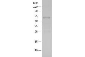 Western Blotting (WB) image for HNF1 Homeobox B (HNF1B) (AA 31-260) protein (His-IF2DI Tag) (ABIN7282391) (HNF1B Protein (AA 31-260) (His-IF2DI Tag))