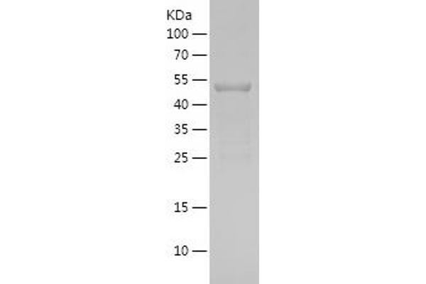 HNF1B Protein (AA 31-260) (His-IF2DI Tag)