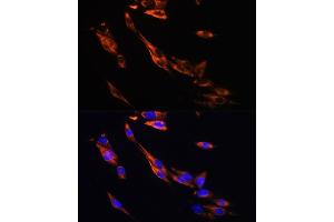 Immunofluorescence (IF) image for anti-Adrenergic, beta-3-, Receptor (ADRB3) (AA 1-100) antibody (ABIN6136599)