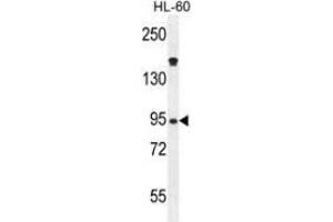 Western blot analysis in HL-60 cell line lysates (35ug/lane) using Myeloperoxidase Antibody (C-term). (Myeloperoxidase antibody  (N-Term))