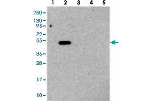 Western blot analysis of Lane 1: RT-4, Lane 2: U-251 MG, Lane 3: Human Plasma, Lane 4: Liver, Lane 5: Tonsil with TMEM39A polyclonal antibody  at 1:250-1:500 dilution.