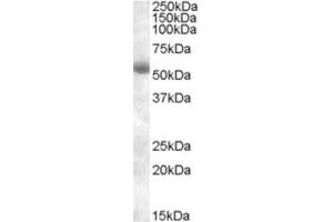 Western Blotting (WB) image for anti-Transmembrane Protease, serine 2 (TMPRSS2) (Internal Region) antibody (ABIN2466752) (TMPRSS2 antibody  (Internal Region))