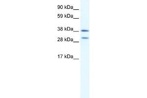 WB Suggested Anti-NKX2-3 Antibody Titration:  0. (NK2 Homeobox 3 antibody  (N-Term))