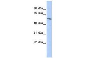 Image no. 1 for anti-B-Cell CLL/lymphoma 6, Member B (BCL6B) (C-Term) antibody (ABIN6740646) (BCL6B antibody  (C-Term))