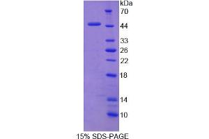 Image no. 1 for NCK Adaptor Protein 1 (NCK1) (AA 2-377) protein (His tag) (ABIN6238343)